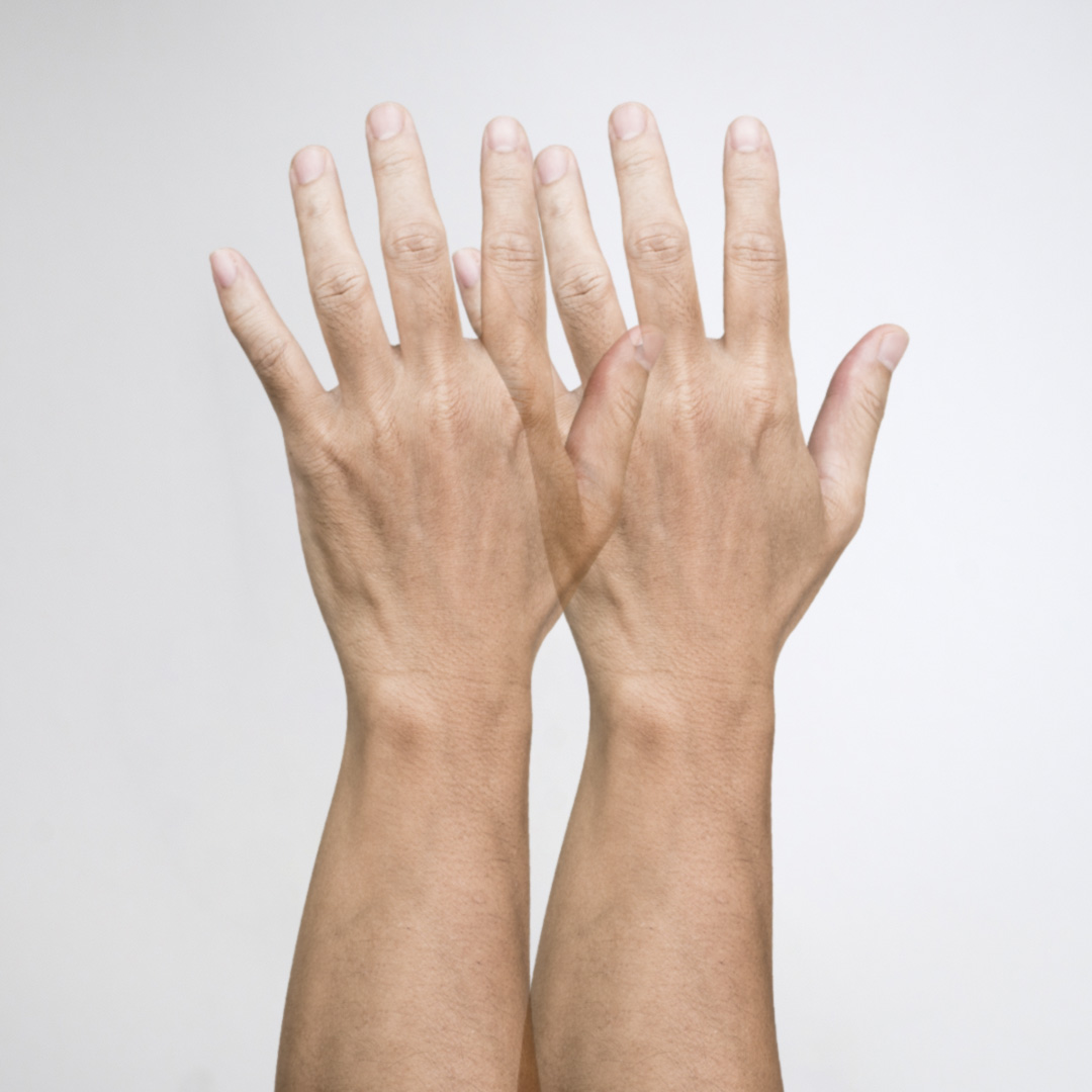 vaakasuora kaksoisnäkö