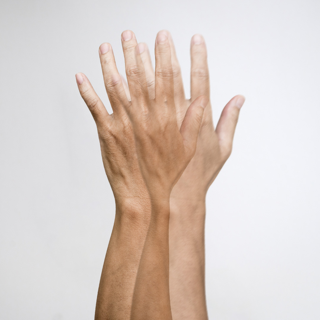 monokulaarinen kaksoisnäkö